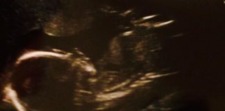 photo of baby ultrasound scan